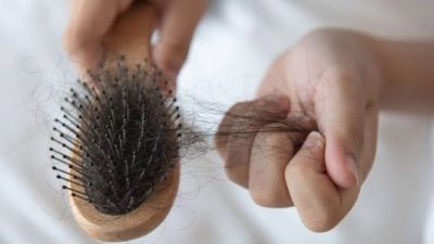 Berikut Cara Ampuh Atasi Rambut Rontok