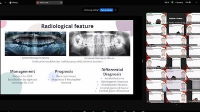 Ahli Bedah Maksilofasial Malaysia Bahas Benign Lesion of The Jaw di Unhas