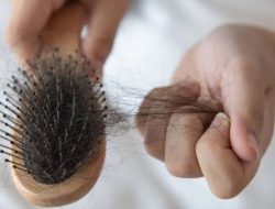 Berikut Cara Ampuh Atasi Rambut Rontok
