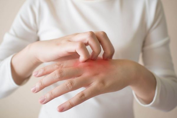 Muncul Alergi? Redakan Gejalanya Dengan Ini