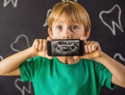 Kenali Tongue-Tie, Kelainan Lidah Bayi Menghambat Proses Menyusu dan Berbicara