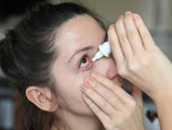 Mata Kering Buat Tak Nyaman? Atasi dengan Cara Ini
