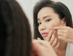 Waspada! 10 Kebiasaan Ini Bikin Jerawat Susah Hilang
