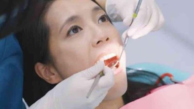 Waspada! Gigi Berlubang Sebabkan Sinusitis