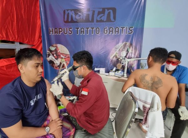 Yayasan Mahtan Hadirkan Hapus Tato Gratis di Makassar