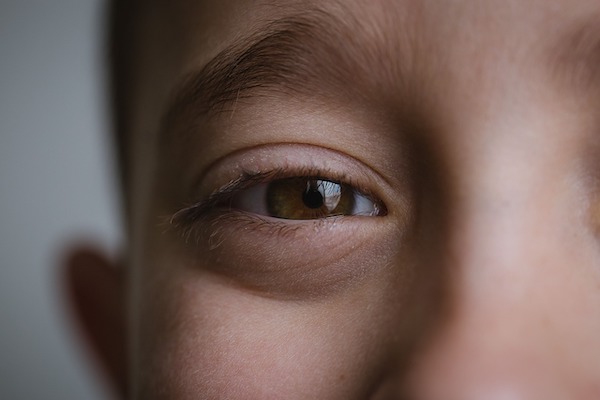 Jangan Abaikan! Astigmatisme Bisa Dialami Anak hingga Lansia