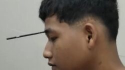 Bermain Ketapel Berujung Petaka, Remaja di Takalar Tertancap Mata Busur di Wajah