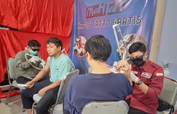 Program Hapus Tato Gratis Digelar di Wajo, Terbuka untuk Umum