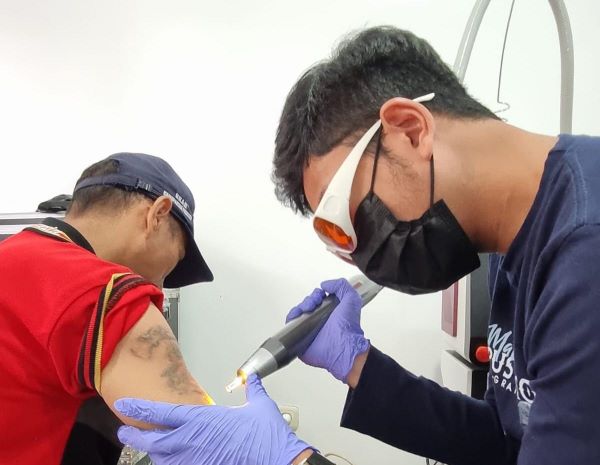 Hapus Tato Gratis Kembali Digelar di Sulbar, Sasar Warga Binaan Lapas Polman