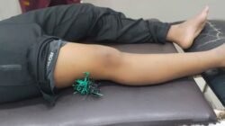 Seorang Pelajar di Takalar Jadi Korban Busur, Paha Tertancap Anak Panah