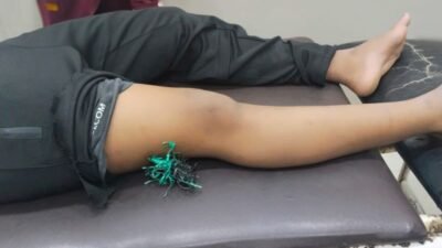 Seorang Pelajar di Takalar Jadi Korban Busur, Paha Tertancap Anak Panah