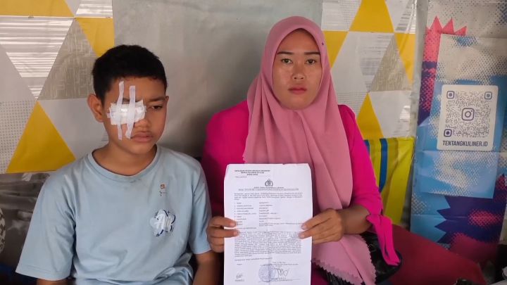 Kena Ketapel Tusuk Bakso, Mata Siswa SMP di Gowa Alami Kebutaan